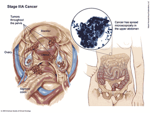 ovary3